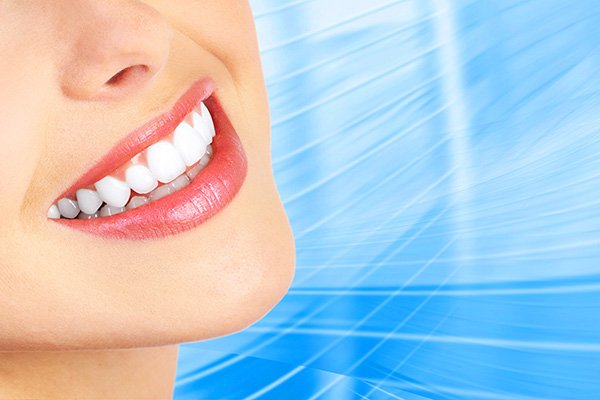 Benefits Of Professional Teeth Bleaching