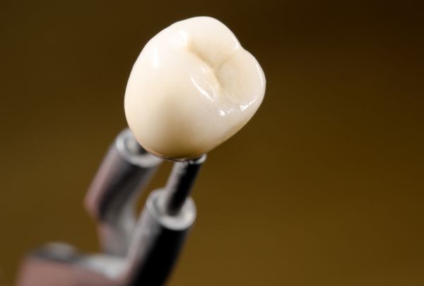 General Dentistry: When Is A Dental Crown Needed?