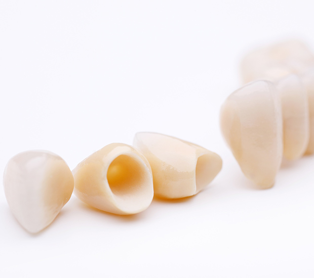 New York Dental Crowns and Dental Bridges