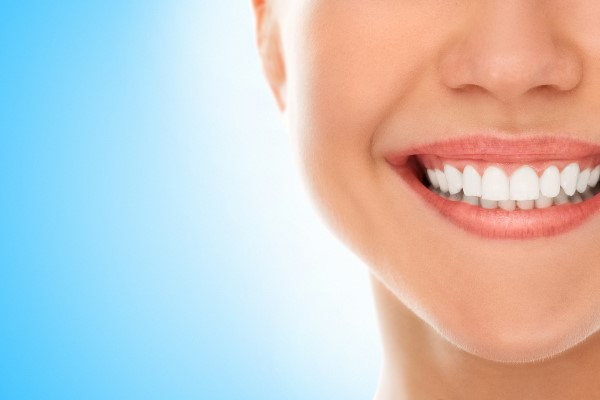 Important Information About Dental Veneers