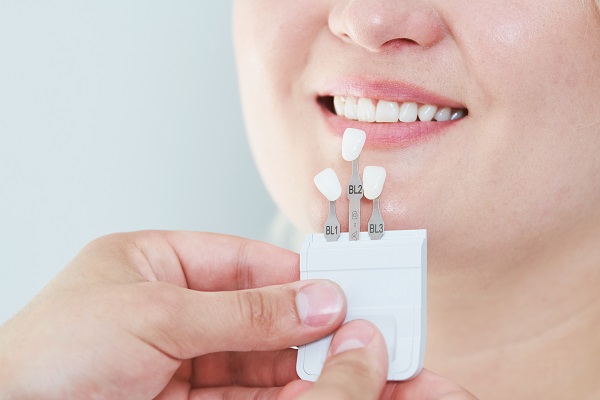 Dental Veneers To Fix A Gap Between Teeth