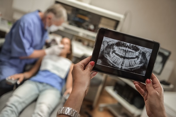 When Does A General Dentist Recommend X Rays?