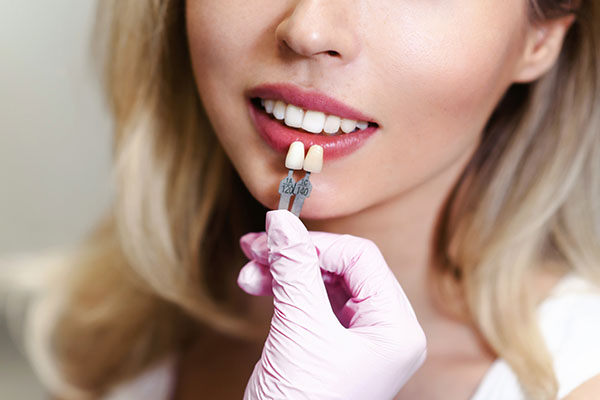 How Effective Are Dental Veneers? from New York Dental Office in New York, NY