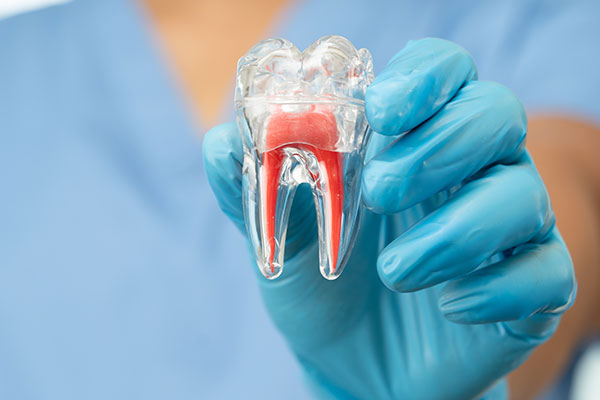 The Root Canal Process From A To Z