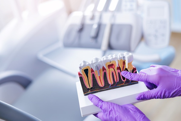 Root Canal Treatment: What To Expect And How It Saves Your Smile
