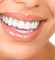 Teeth Whitening Services New York, NY