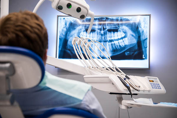 Preventative Dental Care: X Rays And Cleanings